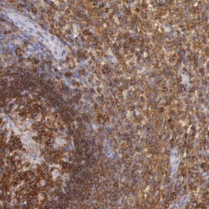 Anti-LYN antibody produced in rabbit 