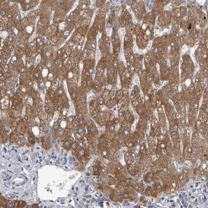 Anti-LYSMD1 antibody produced in rabbit HPA028055-100UL
