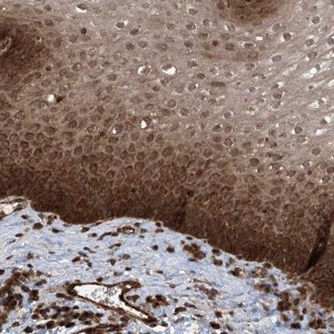 Anti-LYSMD4 antibody produced in rabbit 