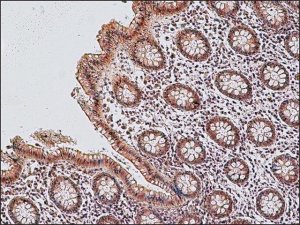 Anti-Lysyl Oxidase (C-terminal) antibody produced in rabbit 