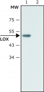 Anti-Lysyl Oxidase antibody produced in rabbit 