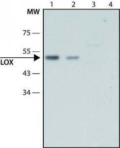 Anti-Lysyl Oxidase antibody produced in rabbit 