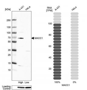 Anti-MACC1 antibody produced in rabbit 
