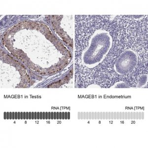 ANTI-MAGEB1 antibody produced in rabbit 