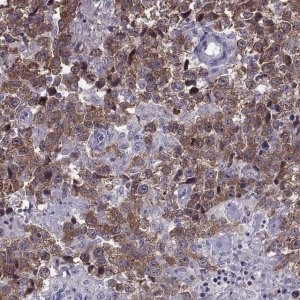 ANTI-MAGEB1 antibody produced in rabbit 