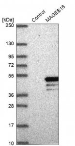 Anti-MAGEB18 antibody produced in rabbit HPA046141-100UL