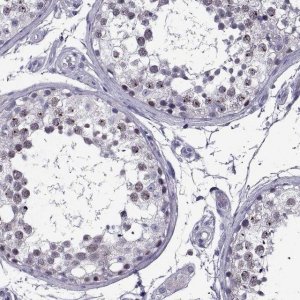 Anti-MAGEB18 antibody produced in rabbit HPA046141-100UL