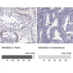 Anti-MAGEB2 