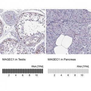 Anti-MAGEC1 antibody produced in rabbit 