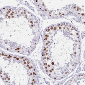 Anti-MAGEC2 antibody produced in rabbit 
