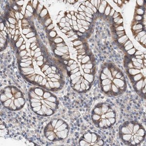 Anti-MAGEE2 antibody produced in rabbit 
