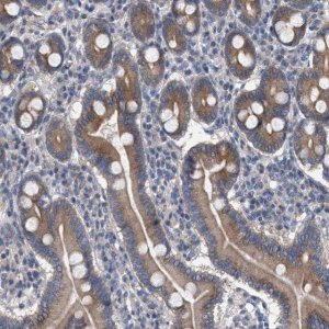 Anti-MAMDC2 antibody produced in rabbit 