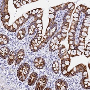 Anti-MAOA antibody produced in rabbit HPA059299-100UL
