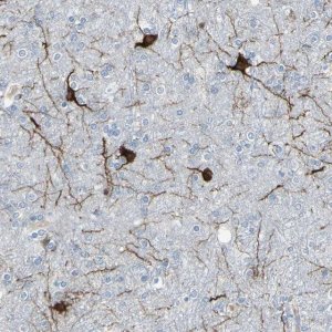 Anti-MAP2 antibody produced in rabbit 
