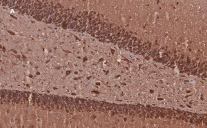 Anti-MAP2 Antibody, clone 3C19, ZooMAb Rabbit Monoclonal 