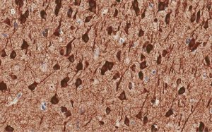 Anti-MAP2 Antibody, clone 3C19, ZooMAb Rabbit Monoclonal 