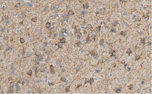 Anti-MAP2 Antibody, clone AP20 ZooMAb Mouse Monoclonal 