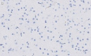 Anti-MAP2 Antibody, clone AP20 ZooMAb Mouse Monoclonal 