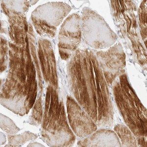 Anti-MAP2K5 antibody produced in rabbit 
