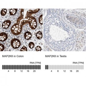 Anti-MAP2K6 antibody produced in rabbit 