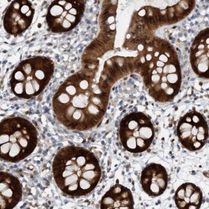 Anti-MAP2K6 antibody produced in rabbit 