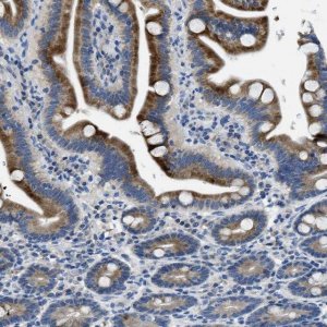 Anti-MAP3K20 antibody produced in rabbit HPA017205-100UL