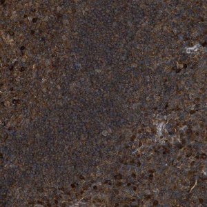 Anti-MAP3K8 antibody produced in rabbit 