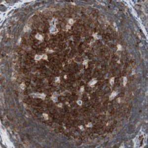 Anti-MAP4K1 antibody produced in rabbit 