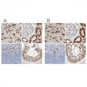 Anti-MAP7 antibody produced in rabbit 