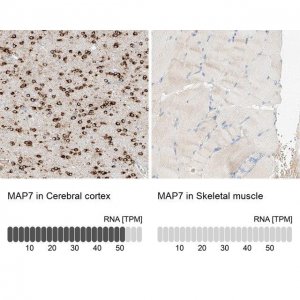 Anti-MAP7 antibody produced in rabbit 