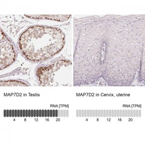Anti-MAP7D2 antibody produced in rabbit 