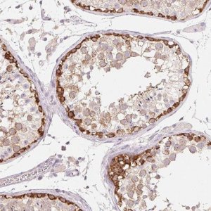 Anti-MAP7D2 antibody produced in rabbit 