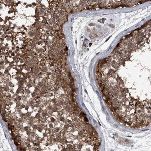 Anti-MAPKAP1 antibody produced in rabbit 