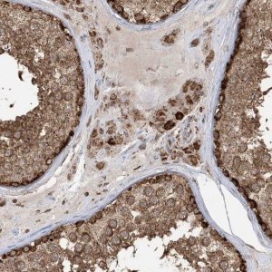 Anti-MAPKBP1 antibody produced in rabbit 