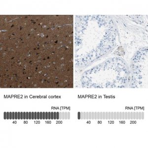Anti-MAPRE2 antibody produced in rabbit 
