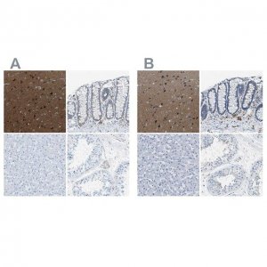 Anti-MAPRE2 antibody produced in rabbit 