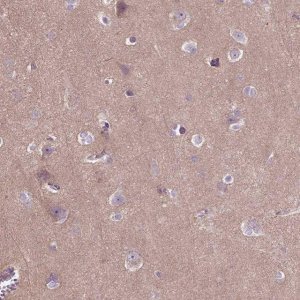 Anti-MAPT antibody produced in rabbit 