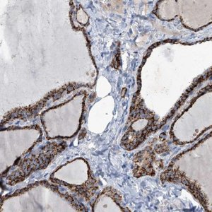 Anti-MARC1 antibody produced in rabbit 