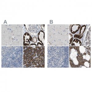Anti-MARC2 antibody produced in rabbit 