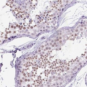 Anti-MARCH10 antibody produced in rabbit 