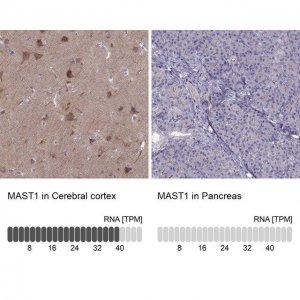 Anti-MAST1 