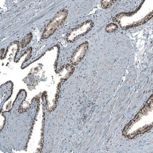Anti-MAT2A antibody produced in rabbit HPA043028-100UL