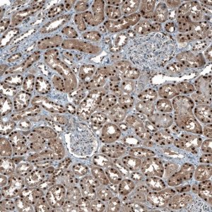 Anti-MAT2A antibody produced in rabbit HPA043028-100UL