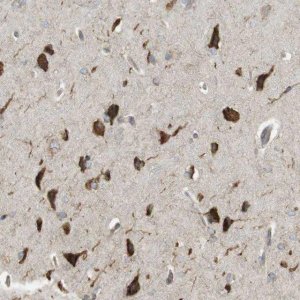 Anti-MBOAT2 antibody produced in rabbit HPA014836-100UL