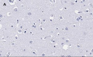 Anti-MBP Antibody, clone 2N6 , ZooMAb Rabbit Monoclonal 