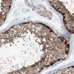 Anti-MCC antibody produced in rabbit 