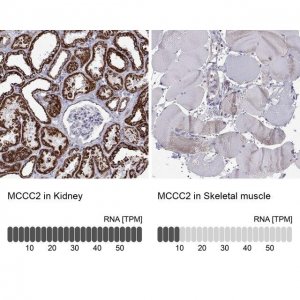 Anti-MCCC2 antibody produced in rabbit 