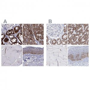 Anti-MCCC2 antibody produced in rabbit 