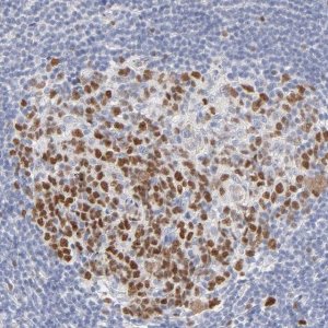 Anti-MCM7 antibody produced in rabbit 