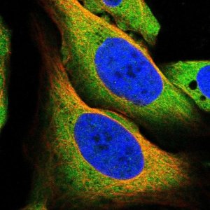 Anti-MCOLN1 antibody produced in rabbit 